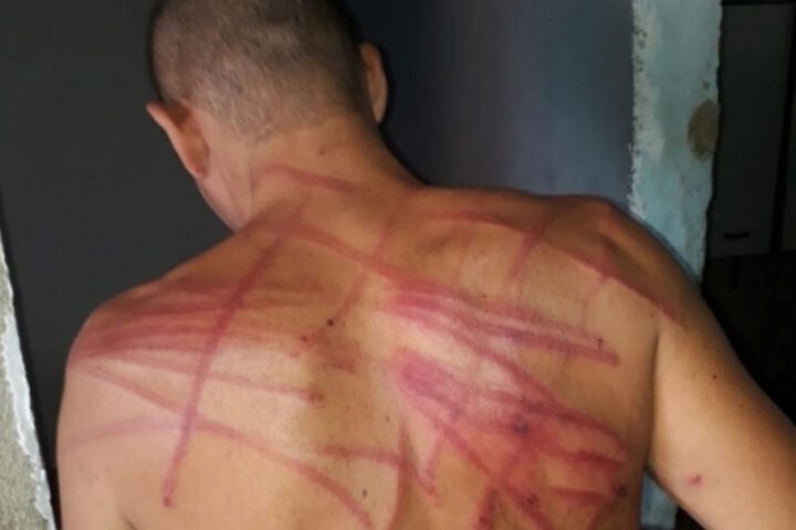 As costas de Bruno ficaram marcadas pelas chicotadas dadas pelos policiais militares